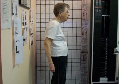 Posture Correction Example 3 - Before